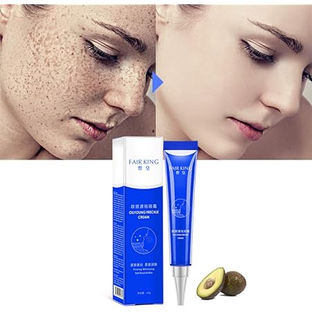 freckle lightening cream