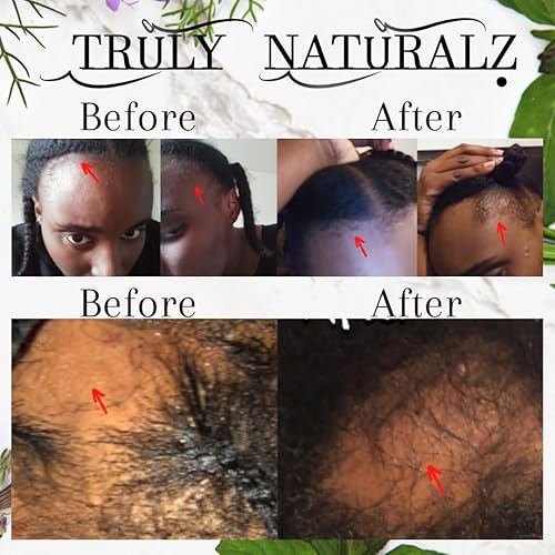 Miniatura 2 de Grasa natural de crecimiento rápido, ideal para el crecimiento del cabello, pérdida de cabello, caspa