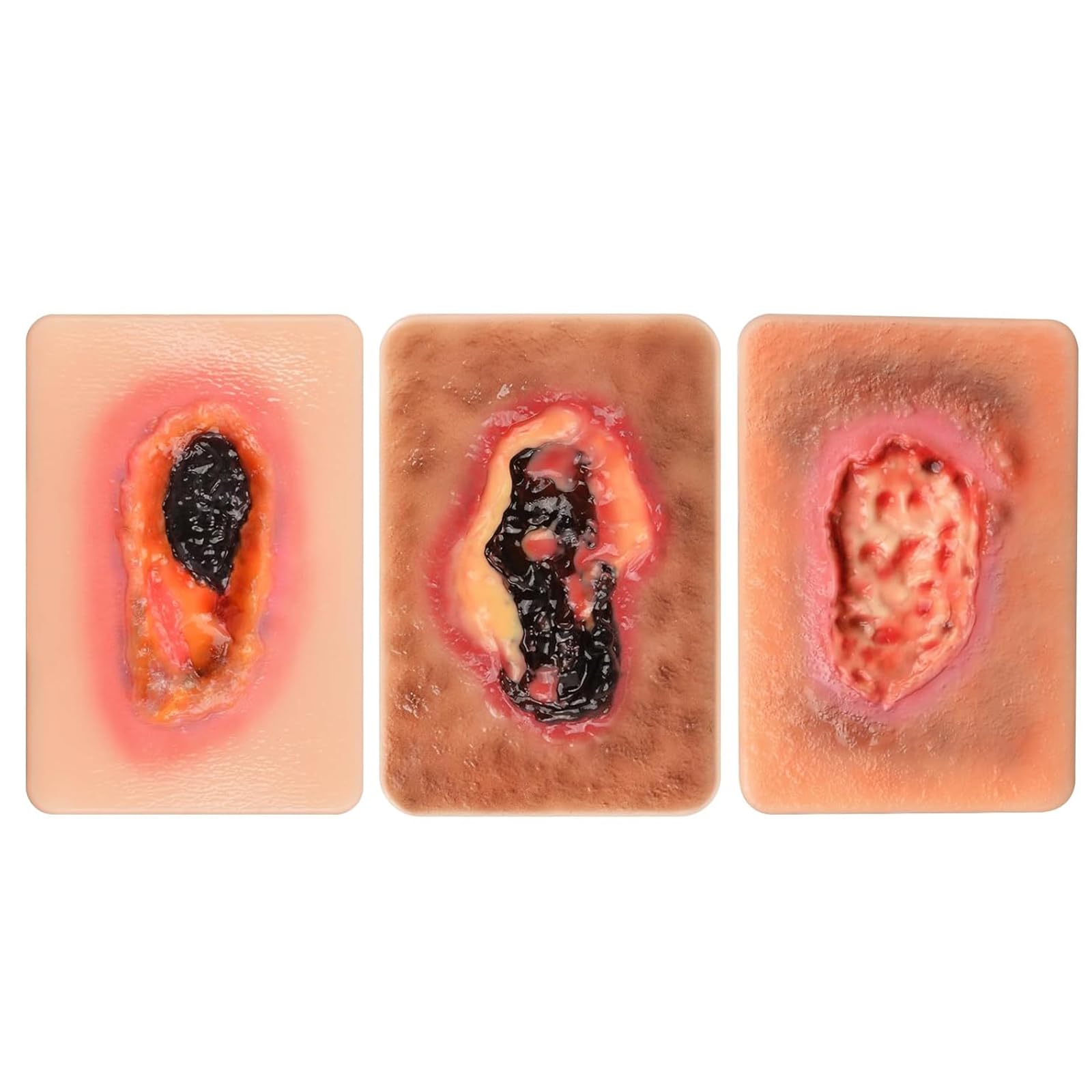 Dispositif De Simulation De Pansement par Granulation (3 Ou 4 Pièces), Modèle De Pansement De La Taille d'une Paume, pour La Formation Médicale Et Les Démonstrations De Soins des Plaies