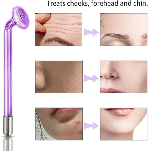 Vista 17 de Electrodo Wand - Tubo de vidrio de mano para instrumento de alta frecuencia Elitzia ETJX006AS (hongo naranja)