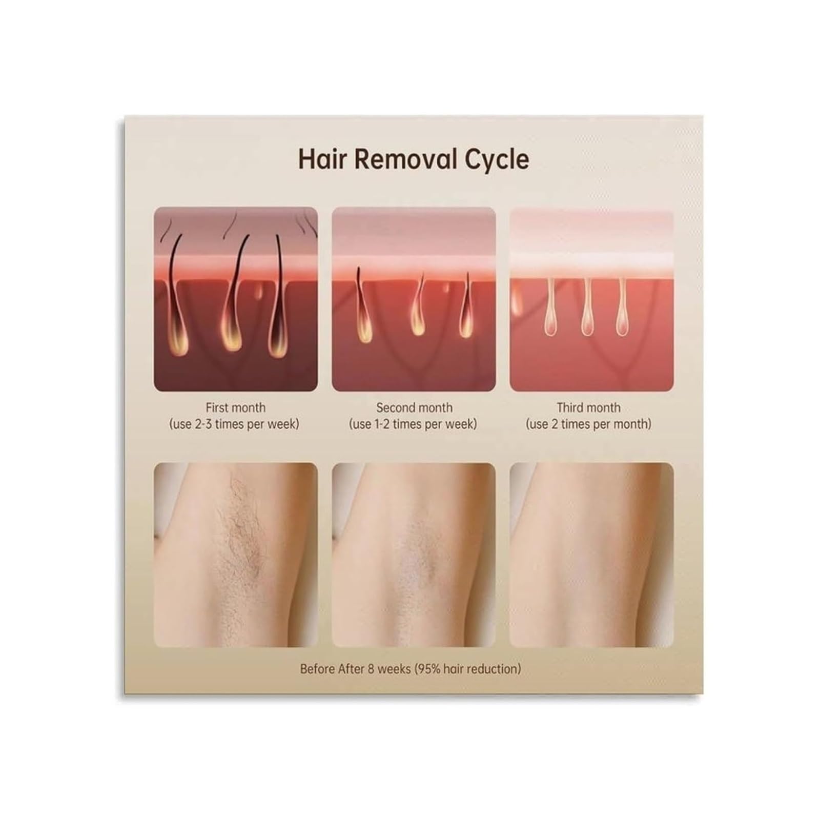 PKNVKZIDK Stages of Hair Growth Poster​ Hair Removal Progress Educational Canvas Wall-Art For Dermatology Clinic Beauty Salon Decor Unframed,08x12inch(20x30cm)