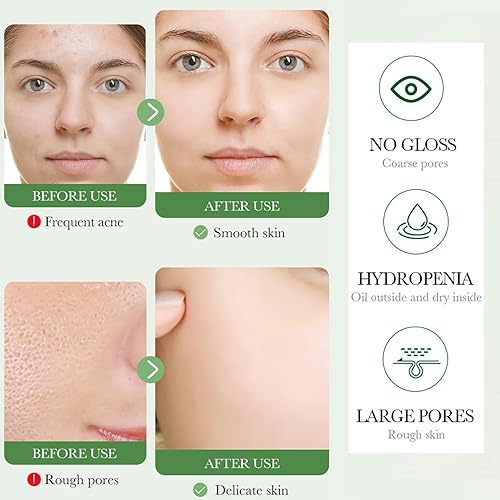 Miniatura 6 de BIOAQUA Centella Asiatica Limpiador Facial Calmante Control de Aceite Anti-Acné Profundo Pore Limpio Facial Hidratante Hidratante 100g3.5oz