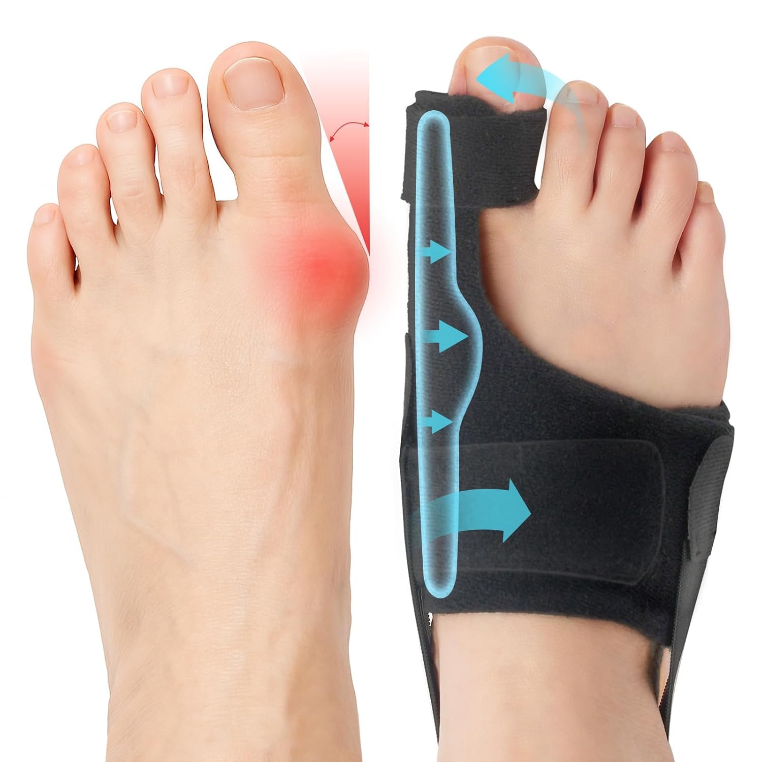 NHCDFA Bunion Corrector for Women, Bunion Thumb Corrector, Right Foot Thumb Bunion Splint Adjustable Toe Separator for Women and Men Correction for Day Night Support