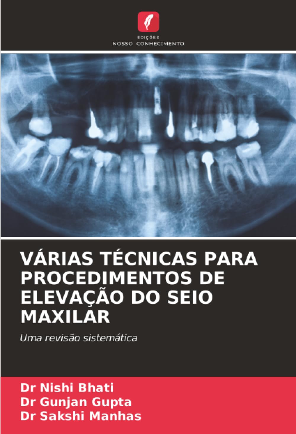 VÁRIAS TÉCNICAS PARA PROCEDIMENTOS DE ELEVAÇÃO DO SEIO MAXILAR: Uma revisão sistemática