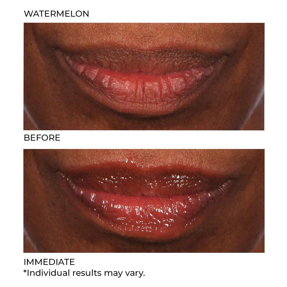 NassifMD Hydro-Screen for Lips