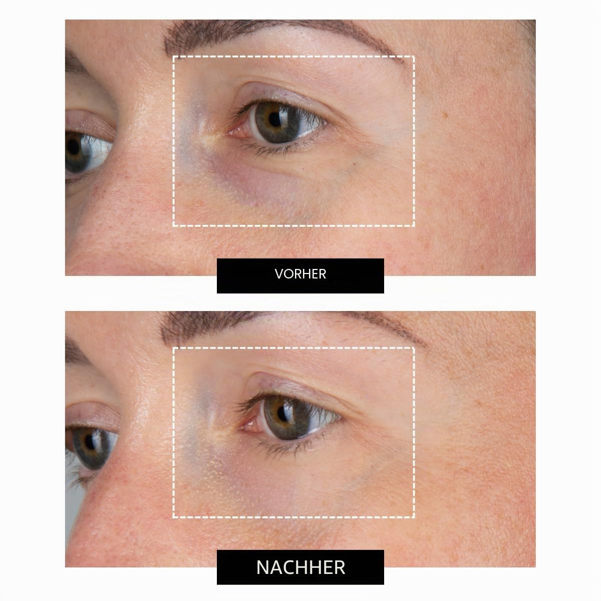CurrentBody Skin LED Eye Perfector : Amazon.de: Beauty