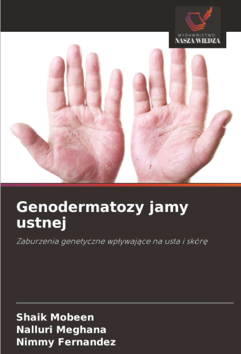 Genodermatozy jamy ustnej: Zaburzenia genetyczne wp¿ywaj¿ce na usta i skór¿