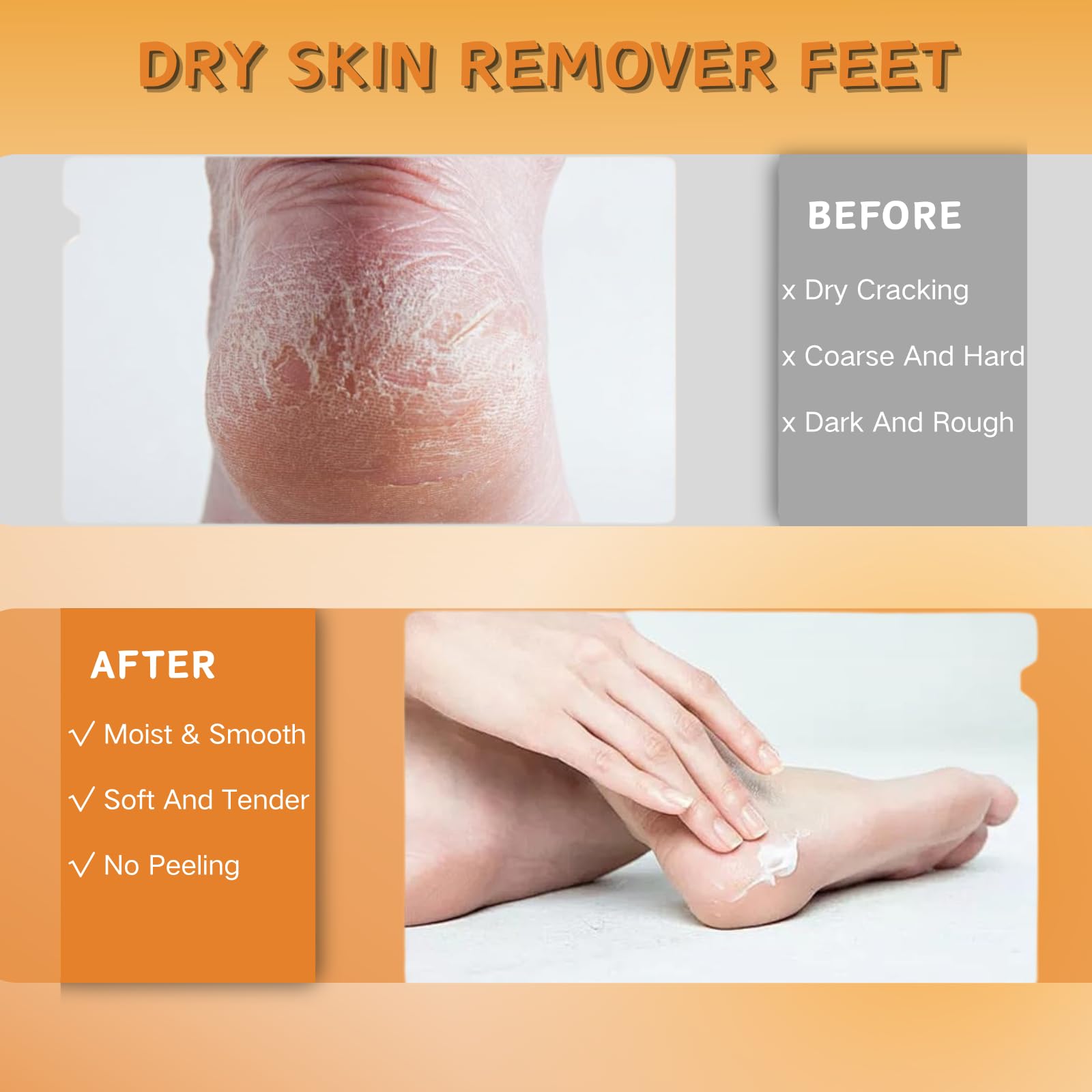 Manuka Honey Heel Balm Stick for Cracked Heel Repair Intensive Foot Cream & Hand Cream for Very Dry Skin Moisturising Stick for Hard Skin 40g Portable Foot Balm *3 Tube - Image 3