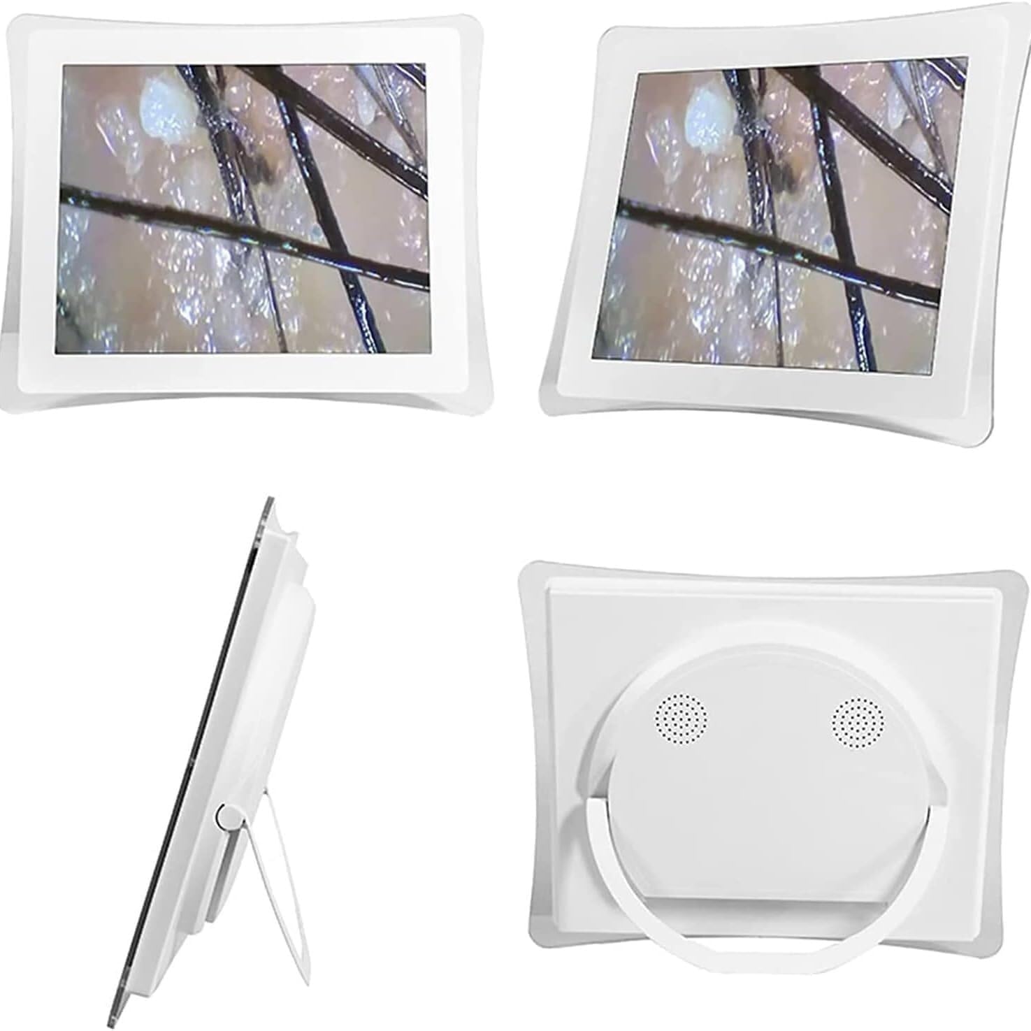 15 Inch Scalp Hair Follicle Detector, 200X/50X Dual Lens Skin Health Detection Machine, HD LCD Screen Microscope Tester, for Home Salon Use