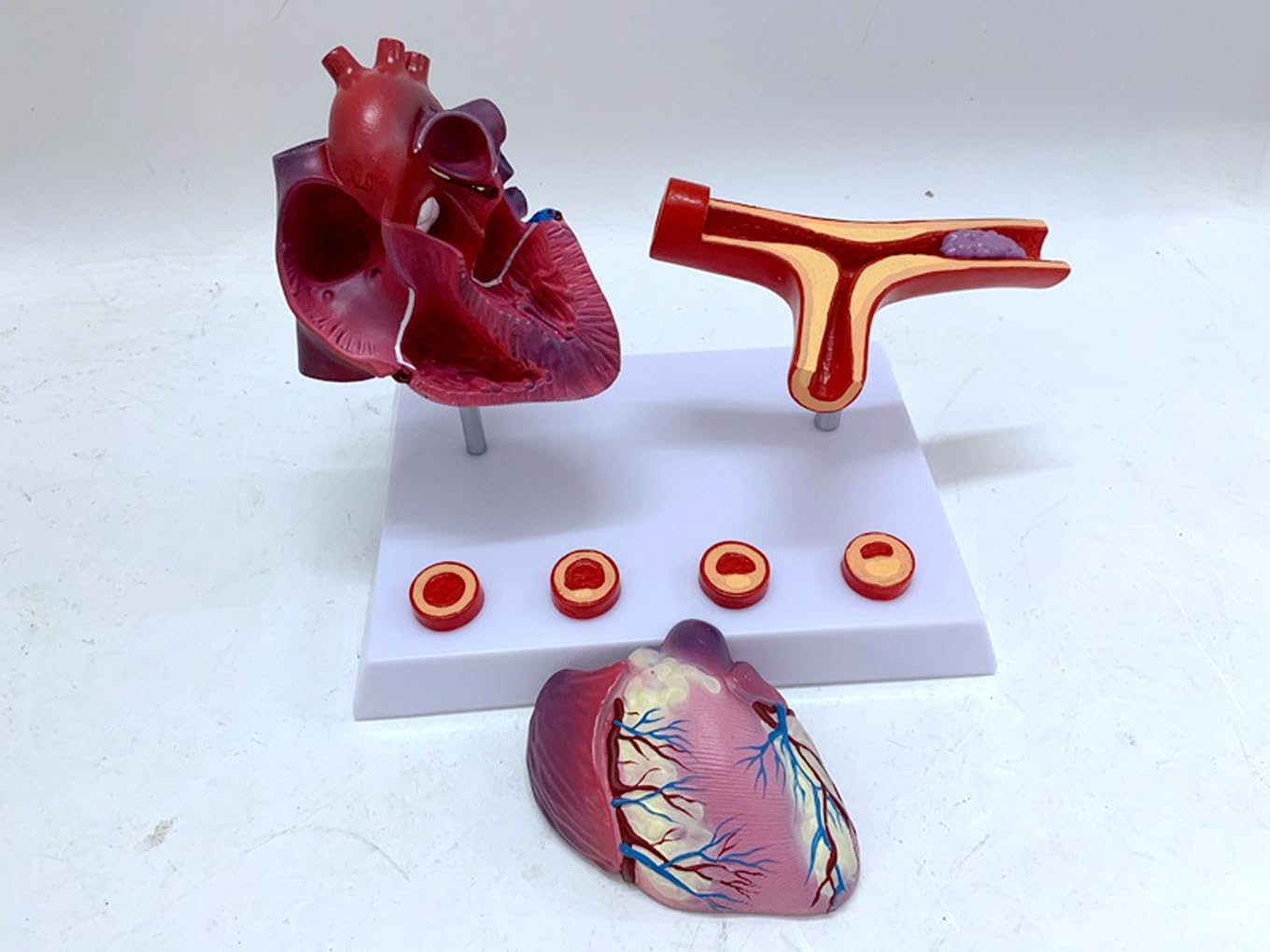 Narzędzia do nauki modelu, nauczanie anatomii serca serca pomostowanie tętnic wieńcowych model z blokadą tętnic i naczyń krwionośnych zakrzepica pomoce dydaktyczne