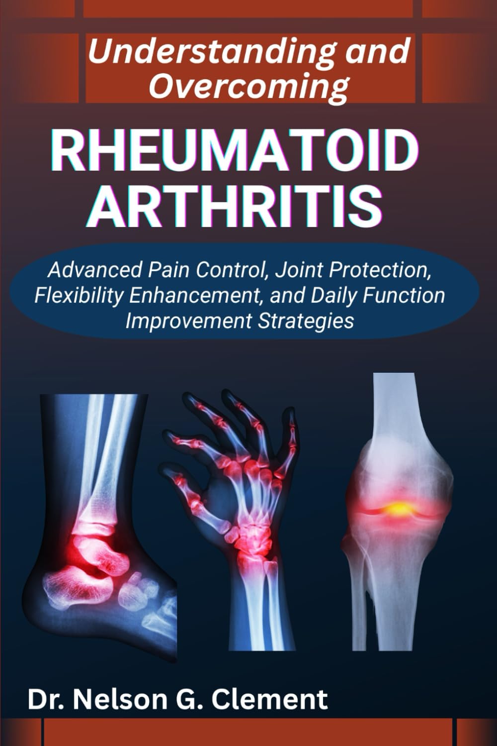 UNDERSTANDING AND OVERCOMING RHEUMATOID ARTHRITIS: Advanced Pain Control, Joint Protection, Flexibility Enhancement, and Daily Function Improvement Strategies
