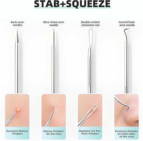 Miniatura 3 de Kit de herramientas de eliminación de puntos negros, herramienta extractora de puntos negros, pinzas de espinillas de acero inoxidable, kit de