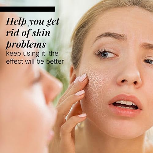 Miniatura 2 de Hilos Tensores Para El Rostro Invisibles Hilos De Colageno Absorbibles Para La Cara, Glicerina Para La Piel, Hilos De Colageno Hilos Para El Rostro