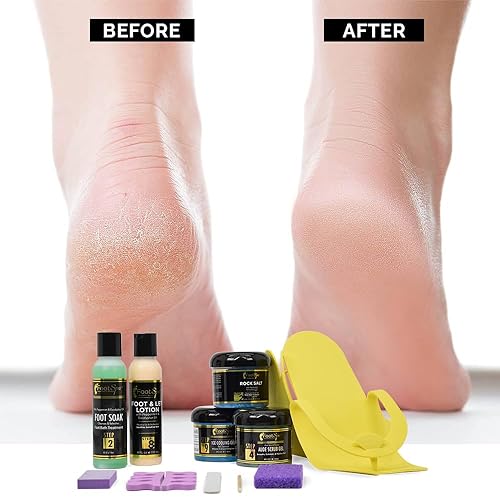 Miniatura 5 de Foot Spa Kit (Mini Kit)