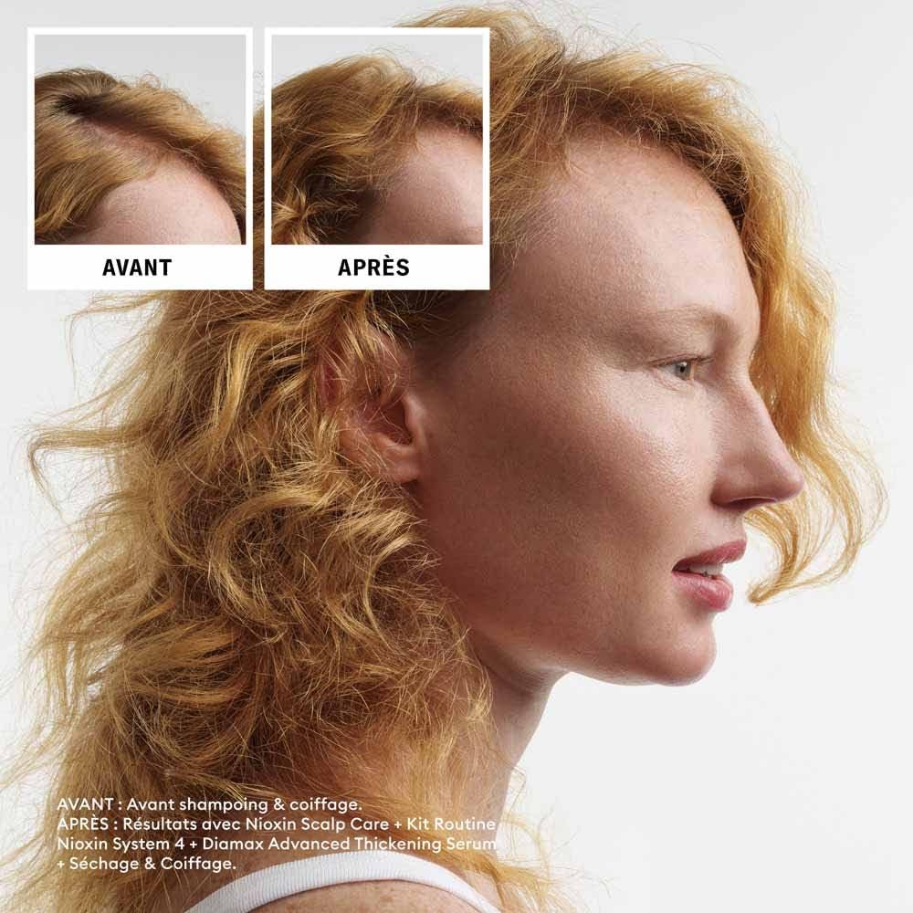 Nioxin Scalp + Hair Kit System 4 – Cuidado del cabello para cabello dañado, visiblemente más fino – Champú, acondicionador y tratamiento para el cuero cabelludo (150 + 150 + 40 ml)