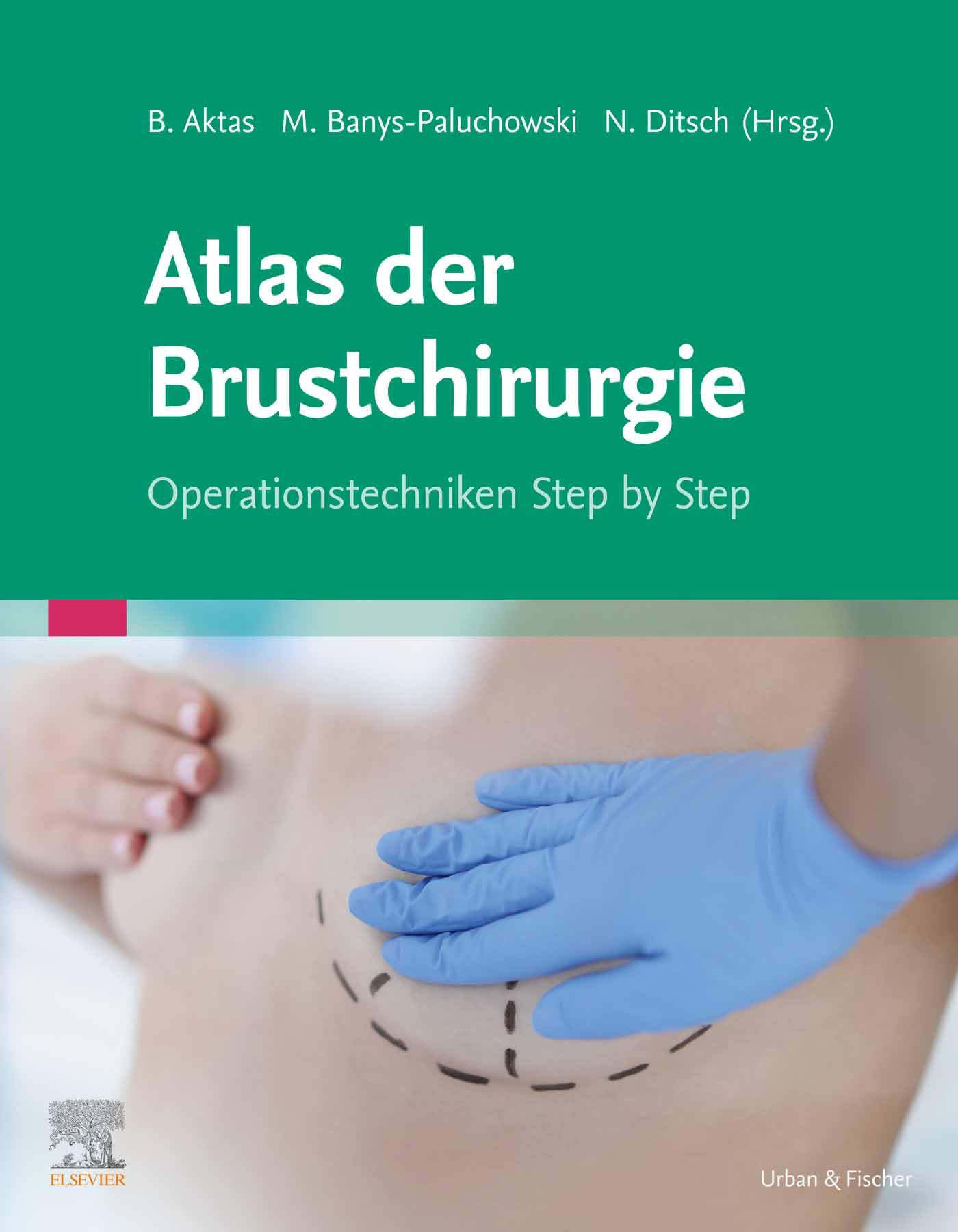 Atlas der Brustchirurgie: Operationstechniken Step by Step (MONOGRAPHIE - Fachbuch - Urban & Fischer-Verlag)