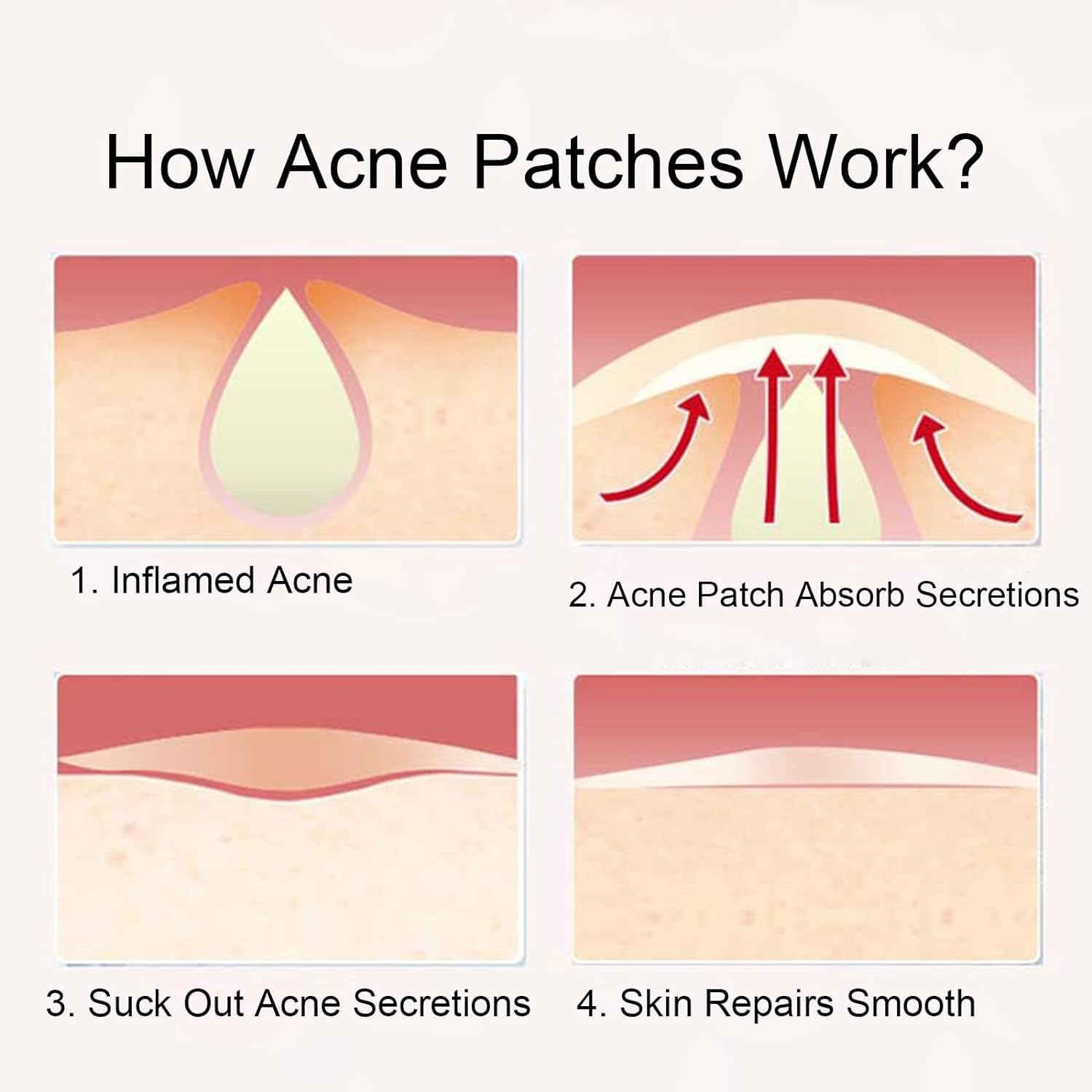 Keli Pimple Patch Hydrocolloid, Pimple Patches, 36 Acne Patches, Acne Plaster, Pimple Acne Patch Plaster in Two Sizes: 24 x 12 mm Diameter and 48 x 0.8 mm Diameter 2