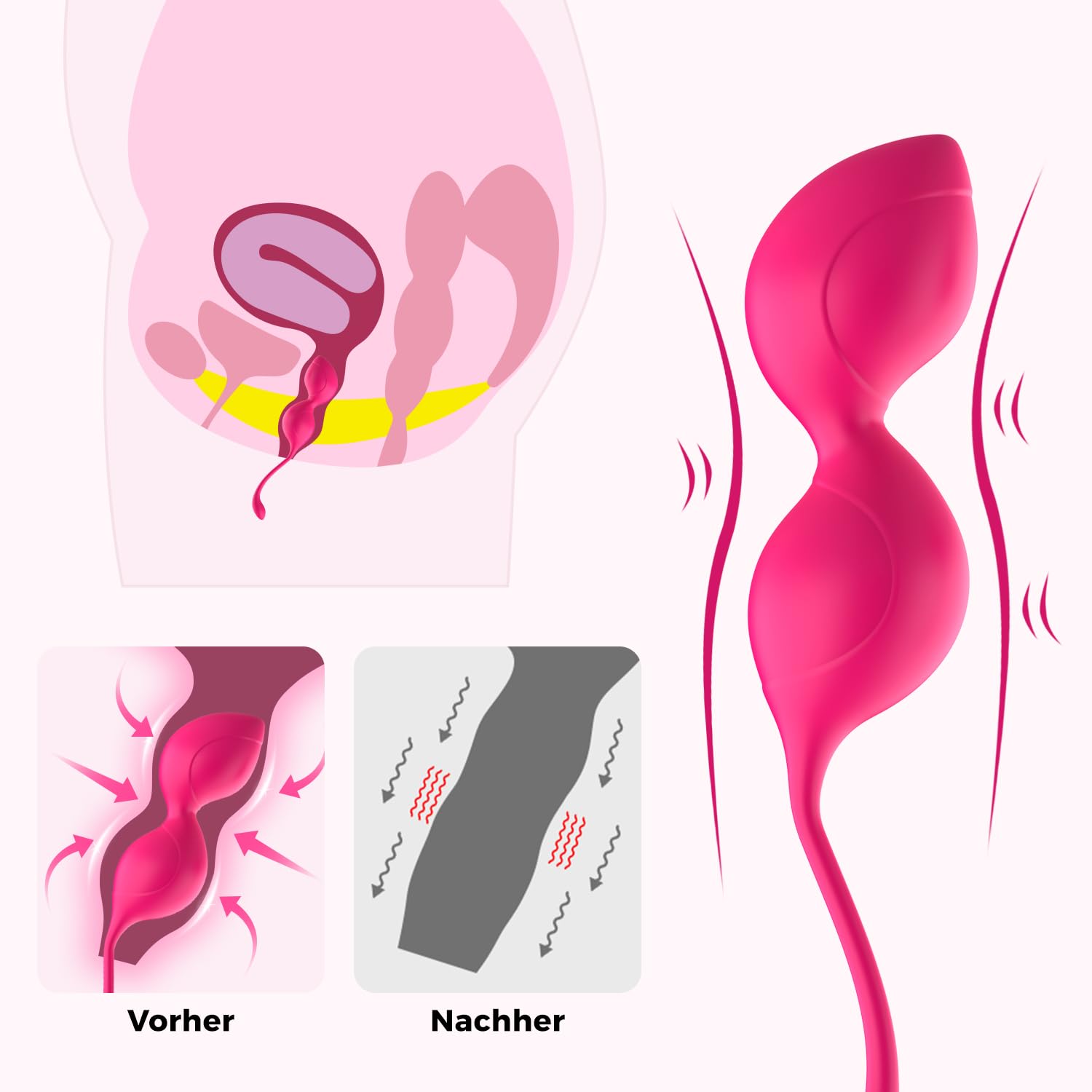 Amore sfere Training, Allmay medica polsino in silicone kegel Balls palline, Piatto fondo Training Aiuto palline da pavimento Trainer, Sex Allenamento per donne