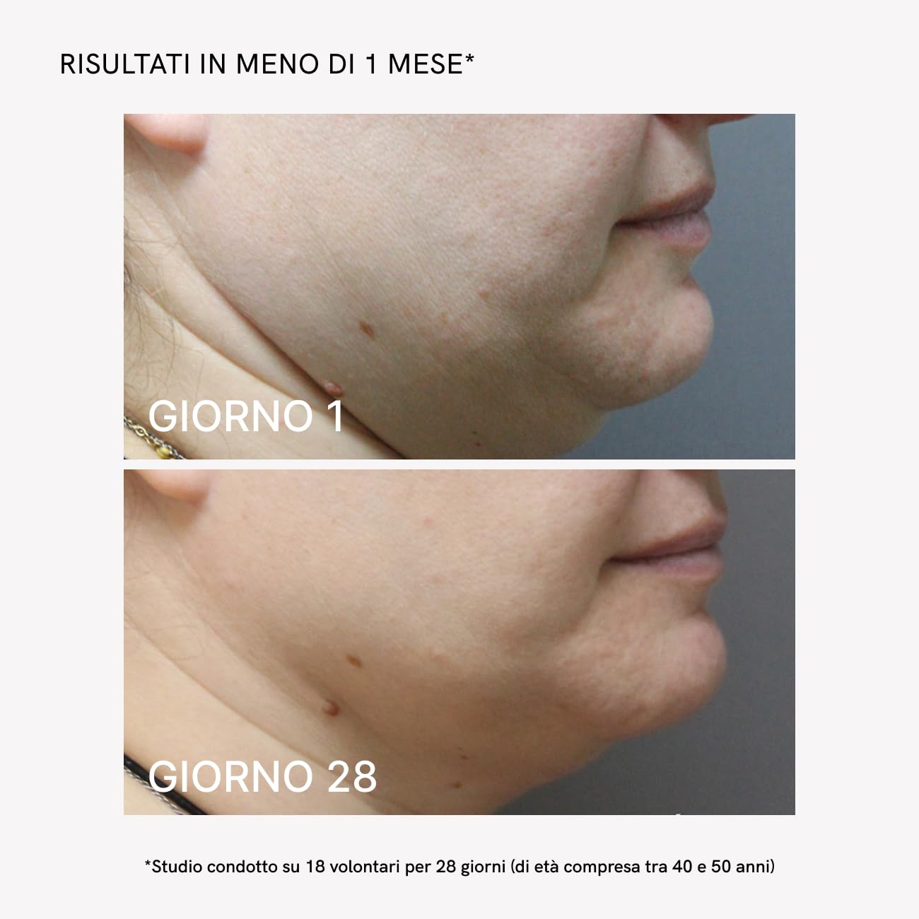 MASDERM | Confezione massaggiatore viso e collo + crema viso a radiofrequenza idratante 500 ml | rassodante antirughe | Massager galvanica facciale | Red Light Therapy Face | Trattamento professionale
