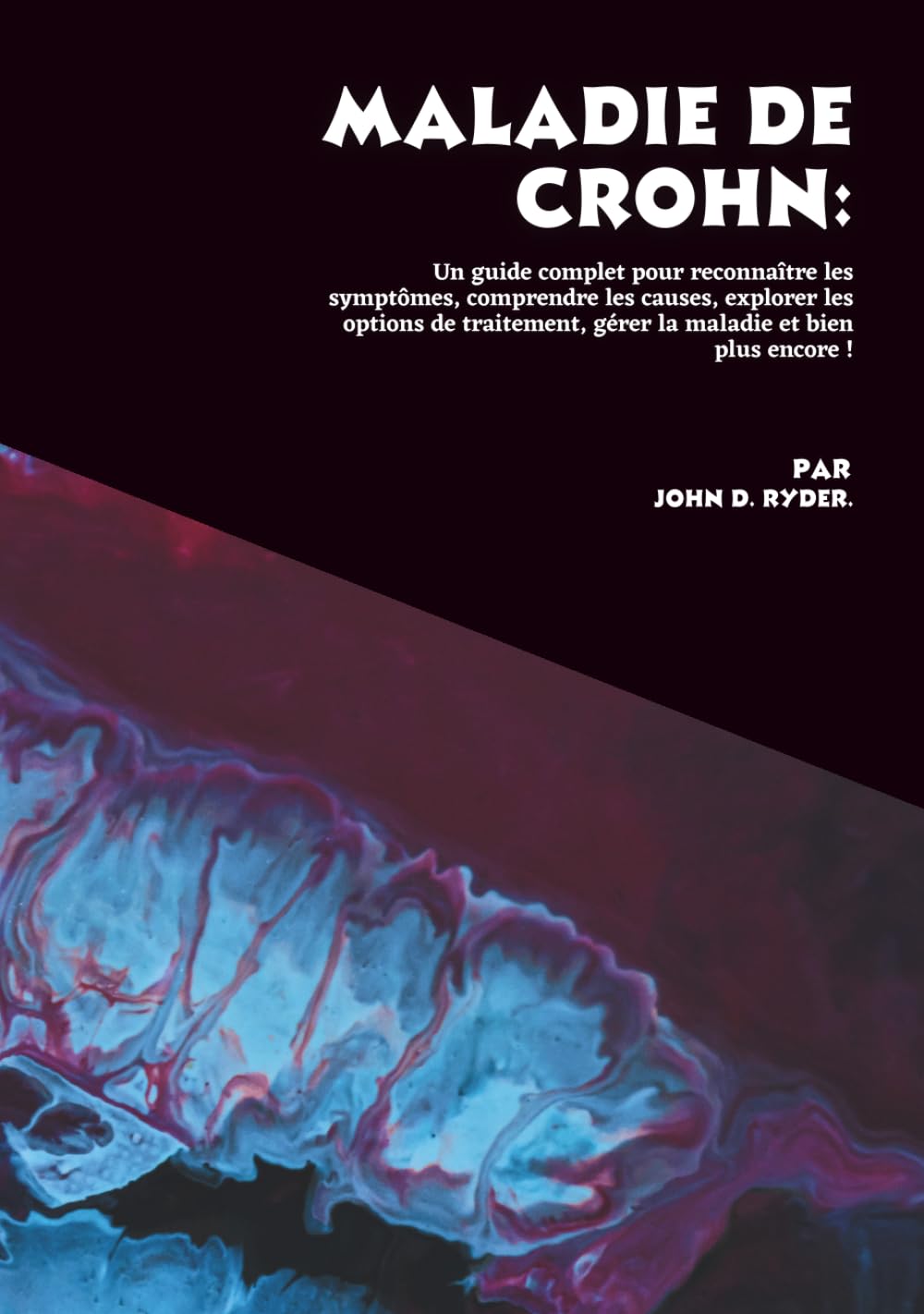 Maladie de Crohn: Un guide complet pour reconnaître les symptômes, comprendre les causes, explorer les options de traitement, gérer la maladie et bien plus encore !