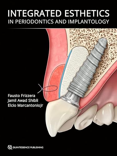 Integrated Esthetics in Periodontics and Implantology