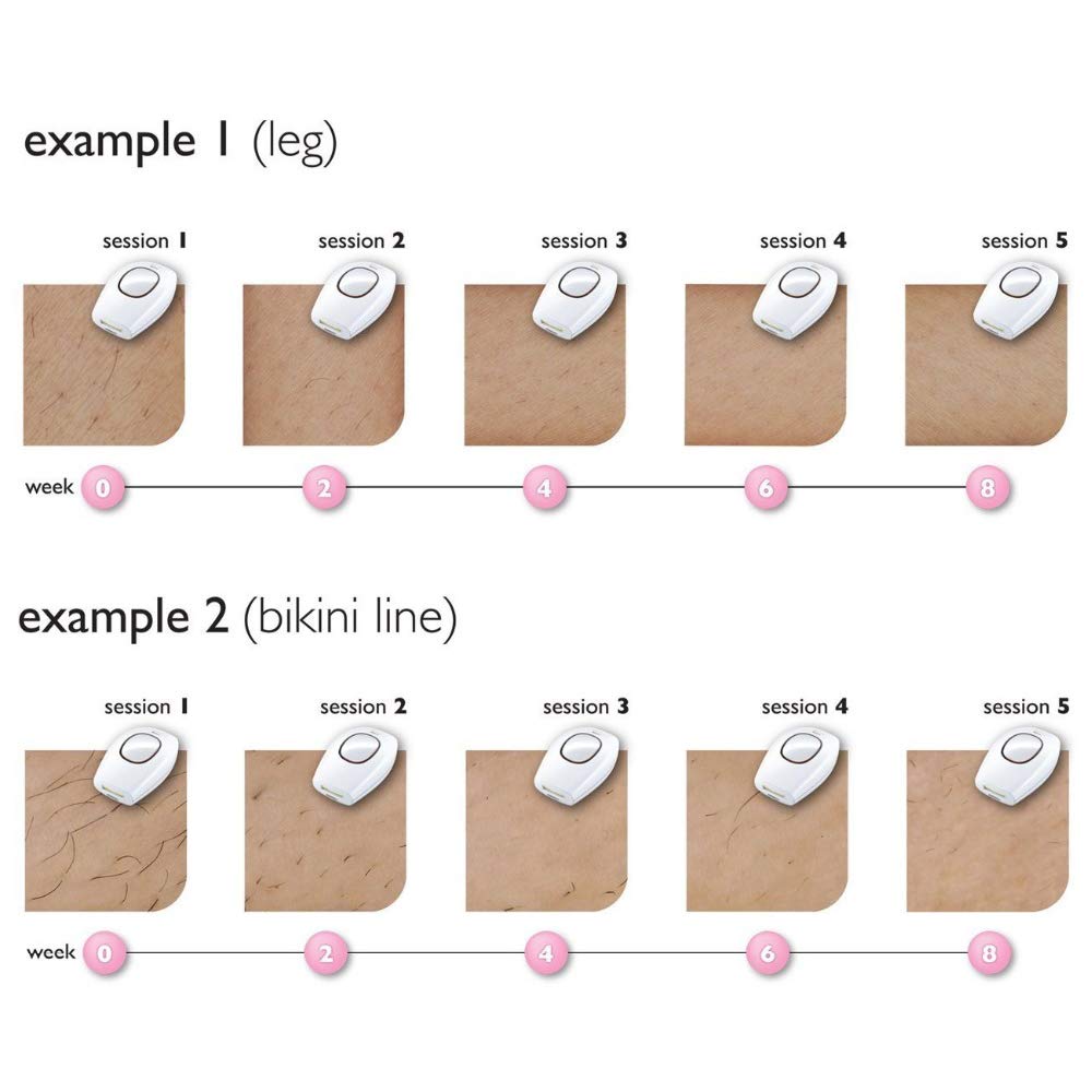 Système d'épilation au laser, épilateur à lumière permanente 2-en-1, 600 000 flashs, convient aux appareils de rajeunissement cutané à la maison pour le visage, les bras, le dos et le bikini