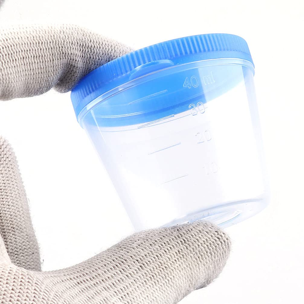 Scicalife 100 Unidades de Vasos de Muestra para Orina Vasos de Plástico para Recolección de Orina Vasos de Muestra con Tapas para Prueba de Embarazo de Laboratorio 40ML