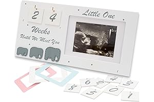 Ultrasound Picture Frame: Capture Every Milestone with Elegance