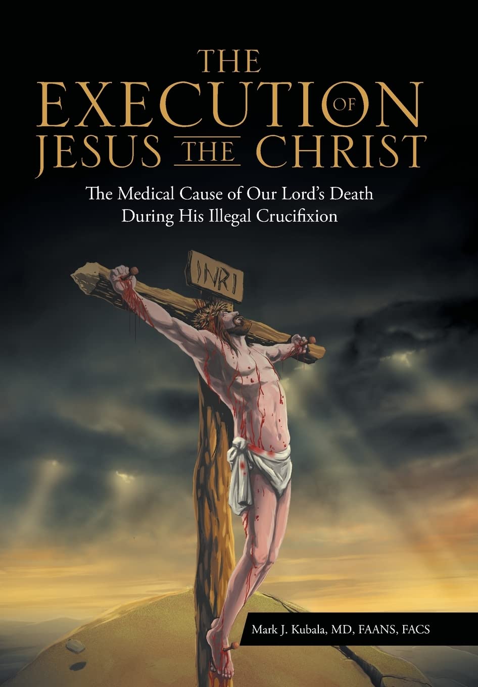 The Execution of Jesus the Christ: The Medical Cause of Our Lord's Death During His Illegal Crucifixion
