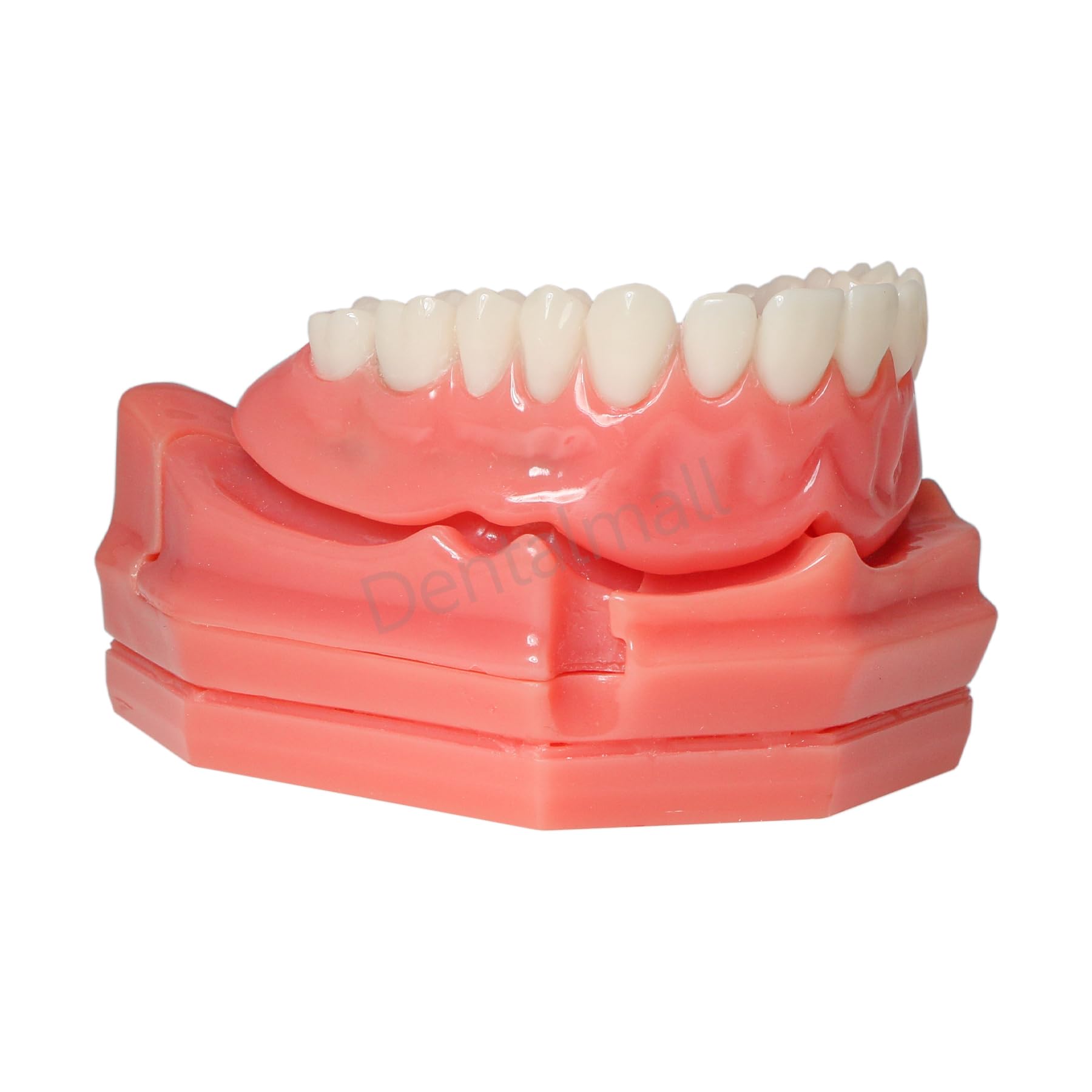 Dental Overdenture Implant Teeth Typodont Model with Jaw and 4 Screws