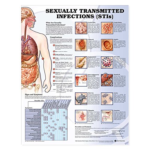 Sexually Transmitted Infections (stis) Chart: (unmounted)