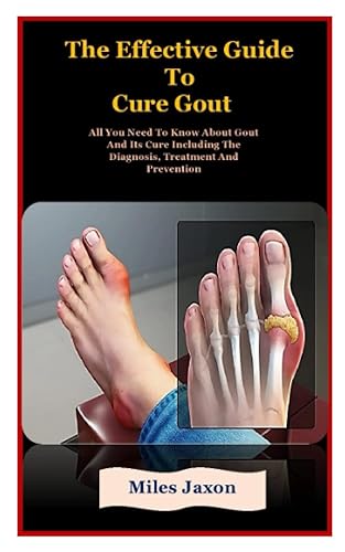 The Effective Guide To Gout Cure: The Effective Guide To Gout Cure: All You Need To Know About Gout And Its Cure Including The Diagnosis, Treatment And Prevention