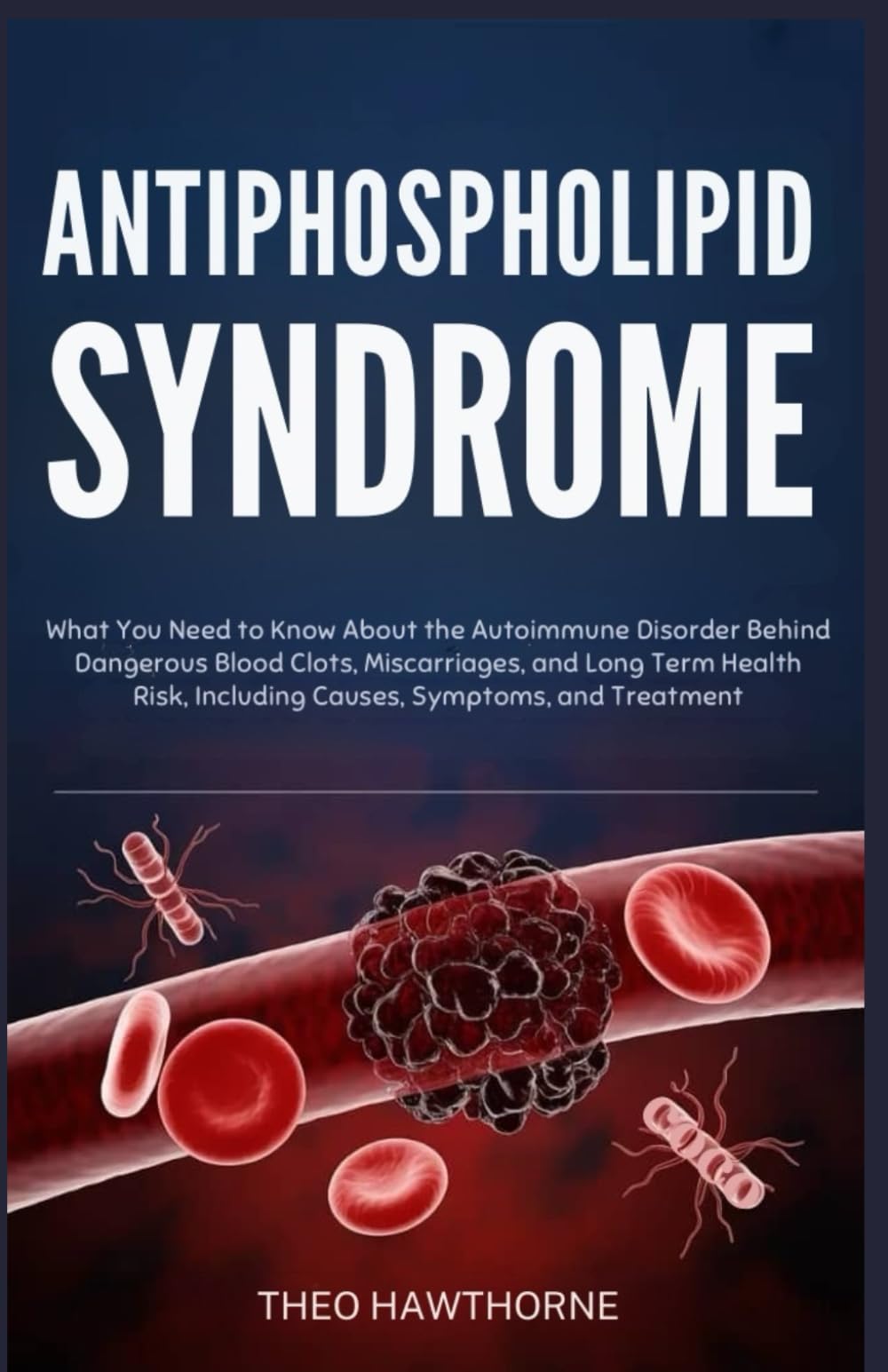 Antiphospholipid Syndrome: What You Need to Know About the Autoimmune Disorder Behind Dangerous Blood Clots, Miscarriages, and Long Term Health Risks, Including Causes, Symptoms, and Treatment