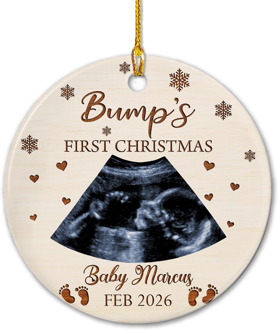 Personalized Bump's First Christmas Ceramic Ornament with Photo Name Year, Baby Bump Sonogram Ultrasound Photo Picture Ceramic Christmas Ornament 2025, Pregnancy Announcement Gifts for Future Dad Mom