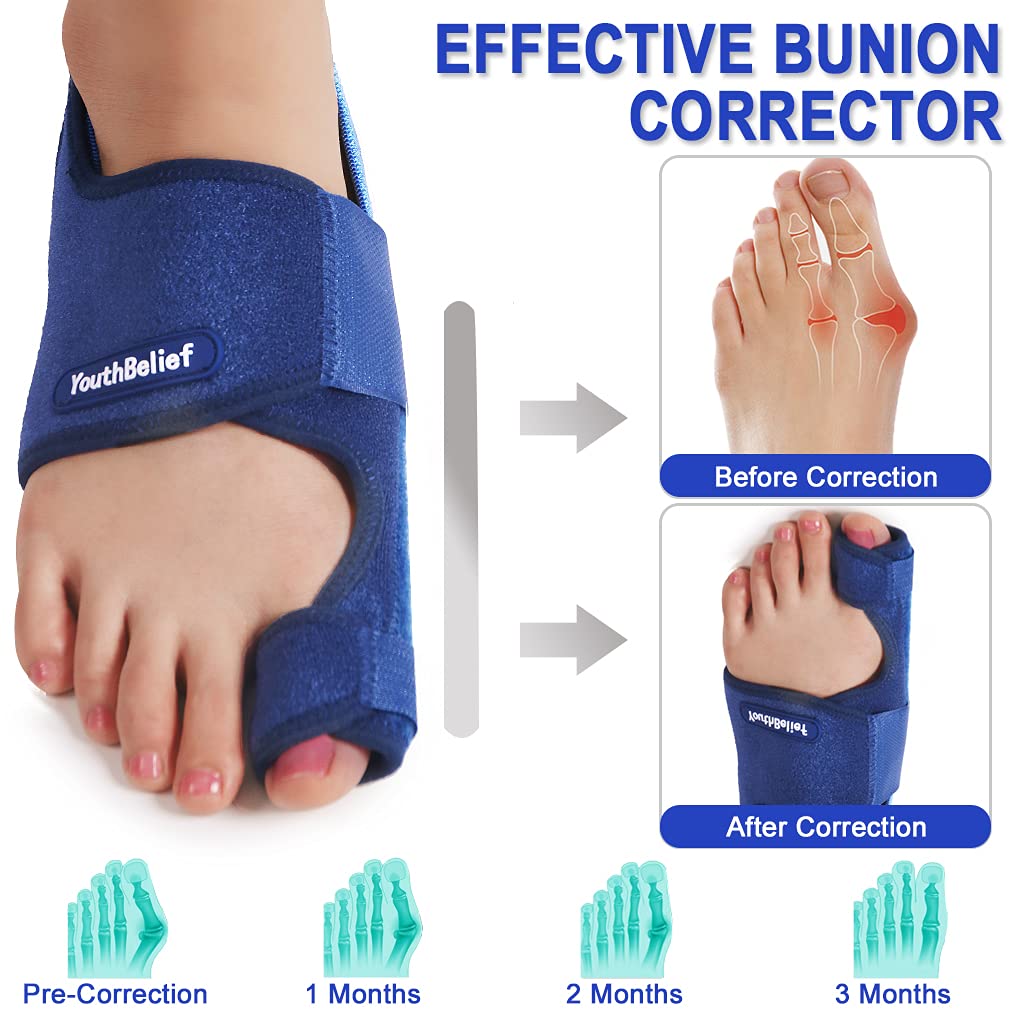 Buy Toe Separator Bunion Corrector Bunion Splint 【2022 Updated】 Hallux