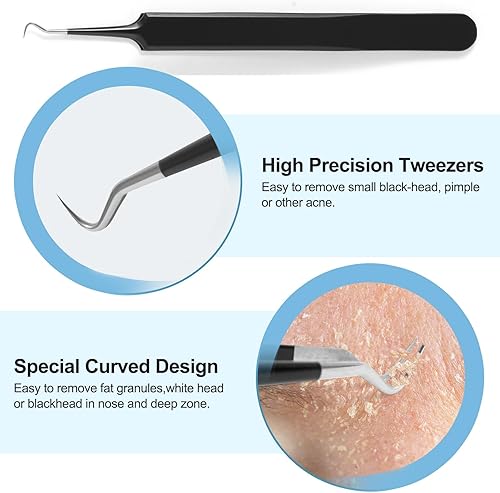 Miniatura 3 de Kit de herramientas para eliminar puntos negros, kit de herramientas para eliminar espinillas, kit de eliminación de acné para manchas, removedor de
