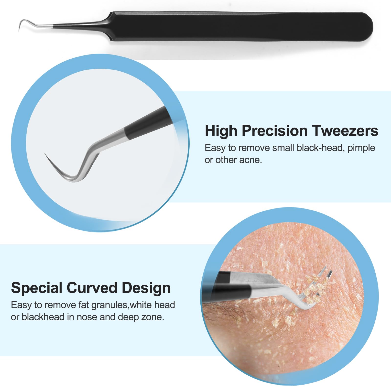Kit de herramientas para eliminar espinillas, extractor de comedones, kit de eliminación de acné para manchas, herramienta de eliminación de puntos negros, tratamiento sin riesgos para imperfecciones,