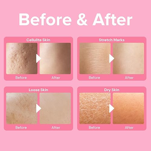 Miniatura 2 de Enaskin Naturals Crema anticelulítica para la celulitis del botín crema reafirmante para el cuerpo para levantar y reafirmar. Crema de estiramiento