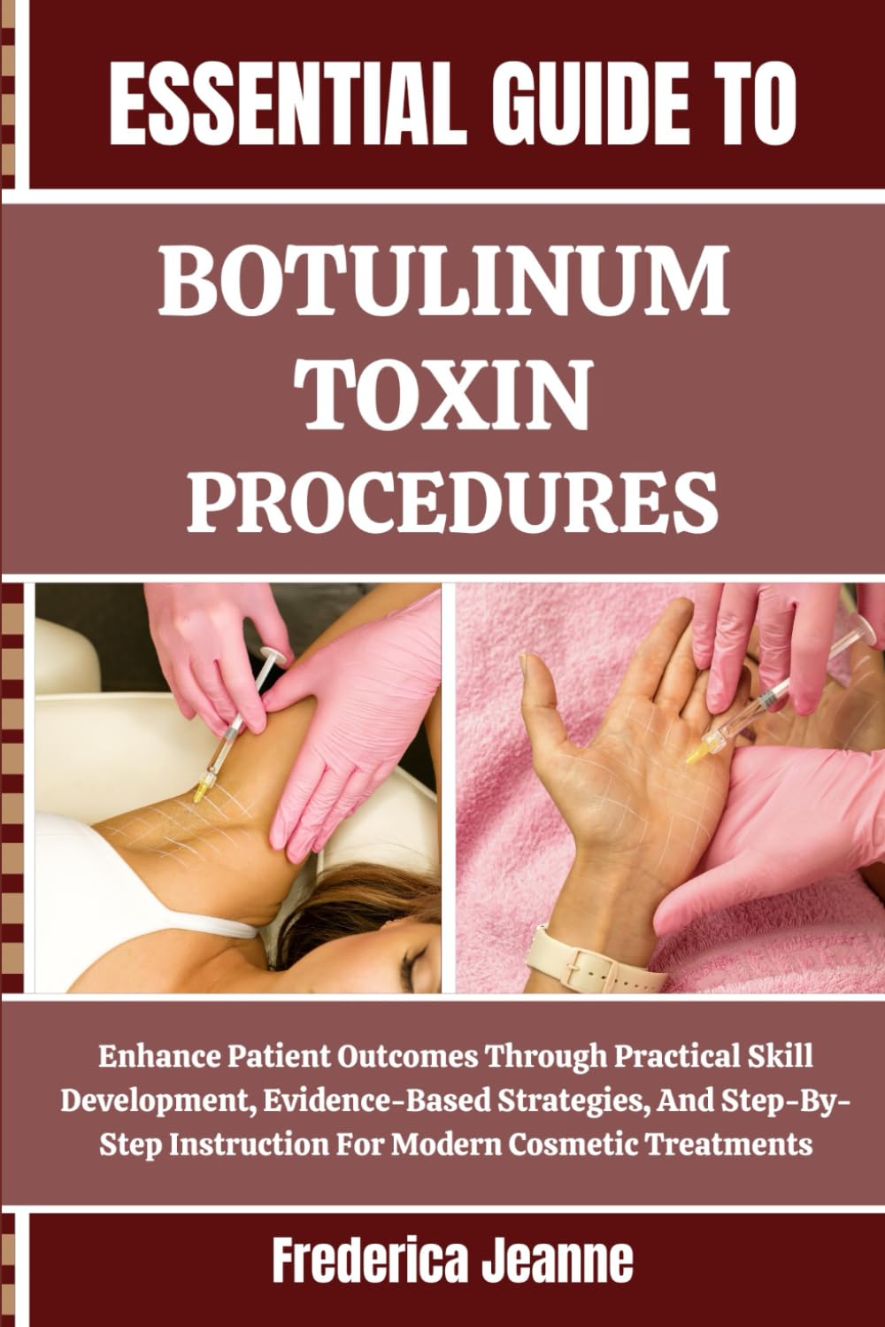 ESSENTIAL GUIDE TO BOTULINUM TOXIN PROCEDURES: Enhance Patient Outcomes Through Practical Skill Development, Evidence-Based Strategies, And Step-By-Step Instruction For Modern Cosmetic Treatments