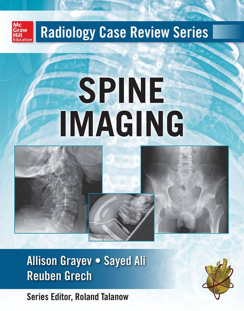 Radiology Case Review Series: Spine: 9780071798082: Medicine