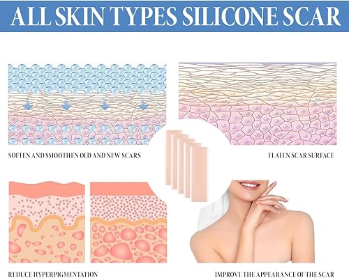 Miniatura 3 de Hojas de silicona para cicatrices, 5 unidades, cinta de silicona para cicatrices de 30 pulgadas, tiras de eliminación de cicatrices sin dolor,