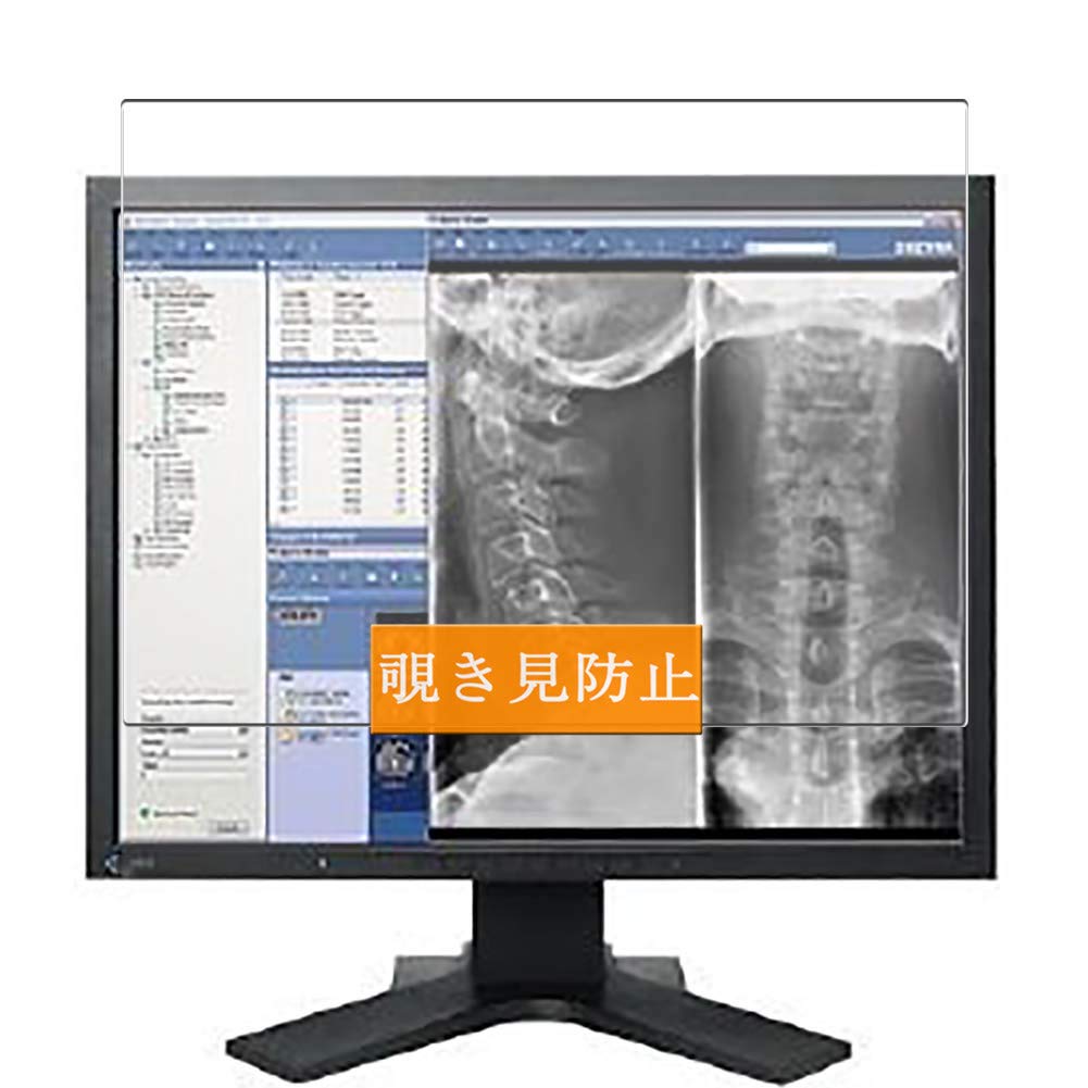 EIZO Radiforce MX210 モニター 本体のみ PCに接続して動作を確認しま