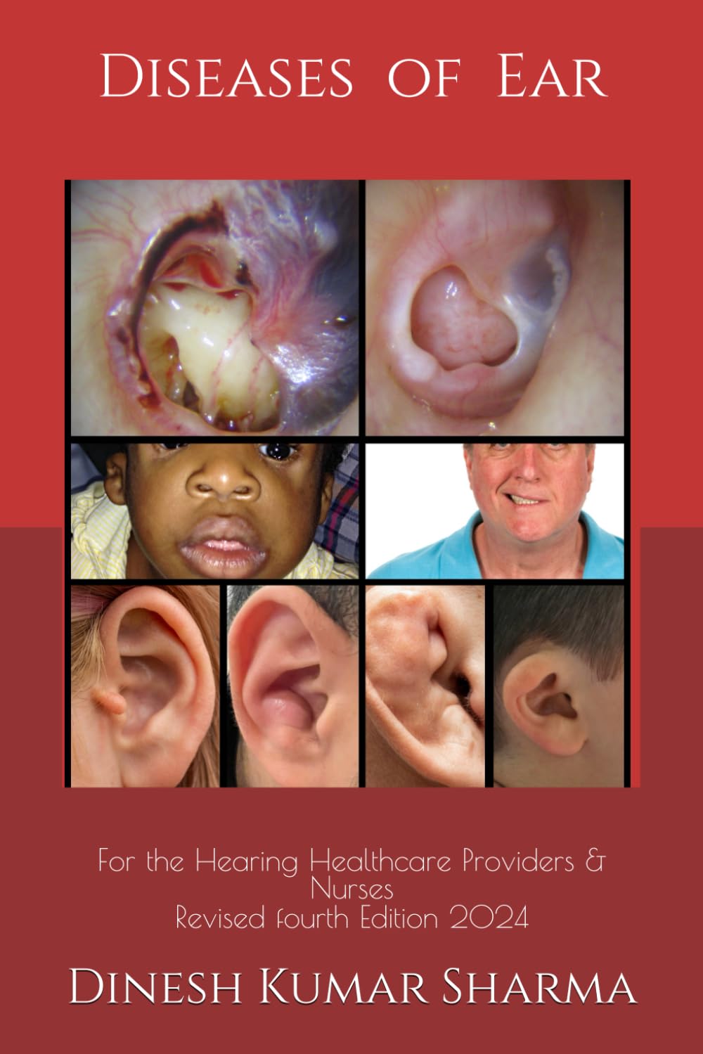 Diseases of Ear: For the Hearing Healthcare Providers & Nurses