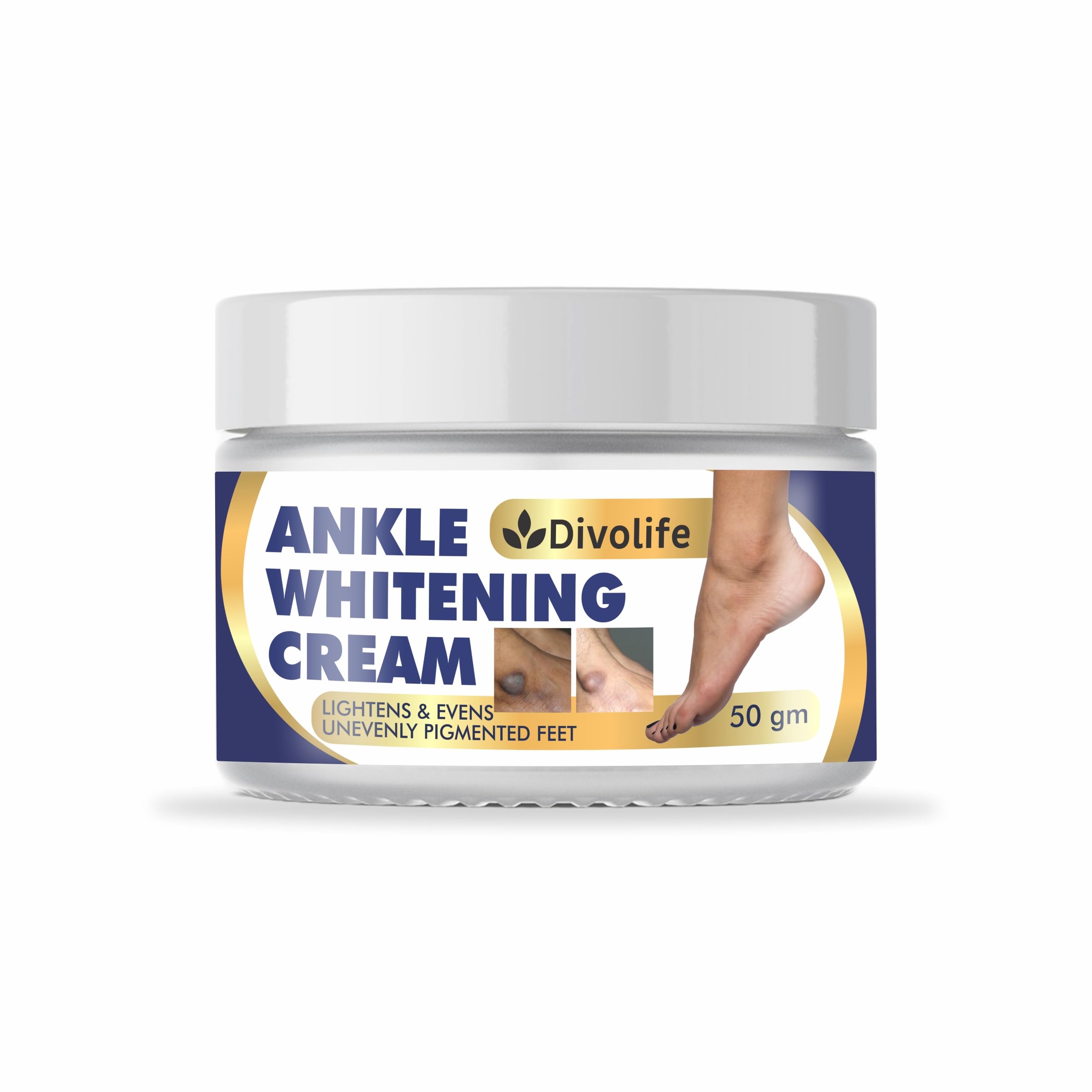 50g Ankle Whitening Cream for Dark Ankles & Pigmented Feet | Skin Brightening & Moisturizing Foot Cream | Helps Reduce Uneven Skin Tone, Dryness & Rough Skin | Daily Foot Care Cream | (White, Pack OF 1)-image-7