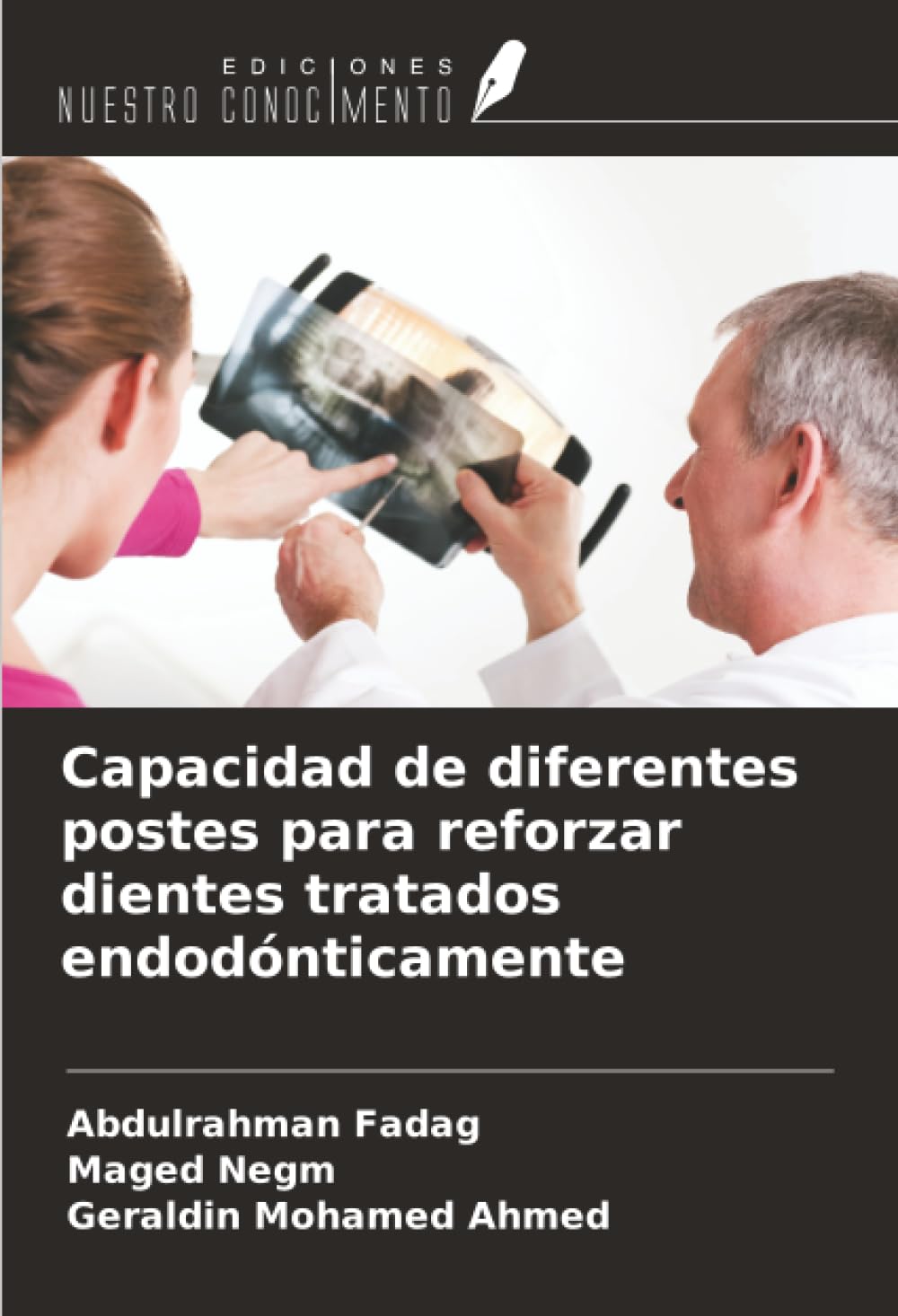 Capacidad de diferentes postes para reforzar dientes tratados endodónticamente