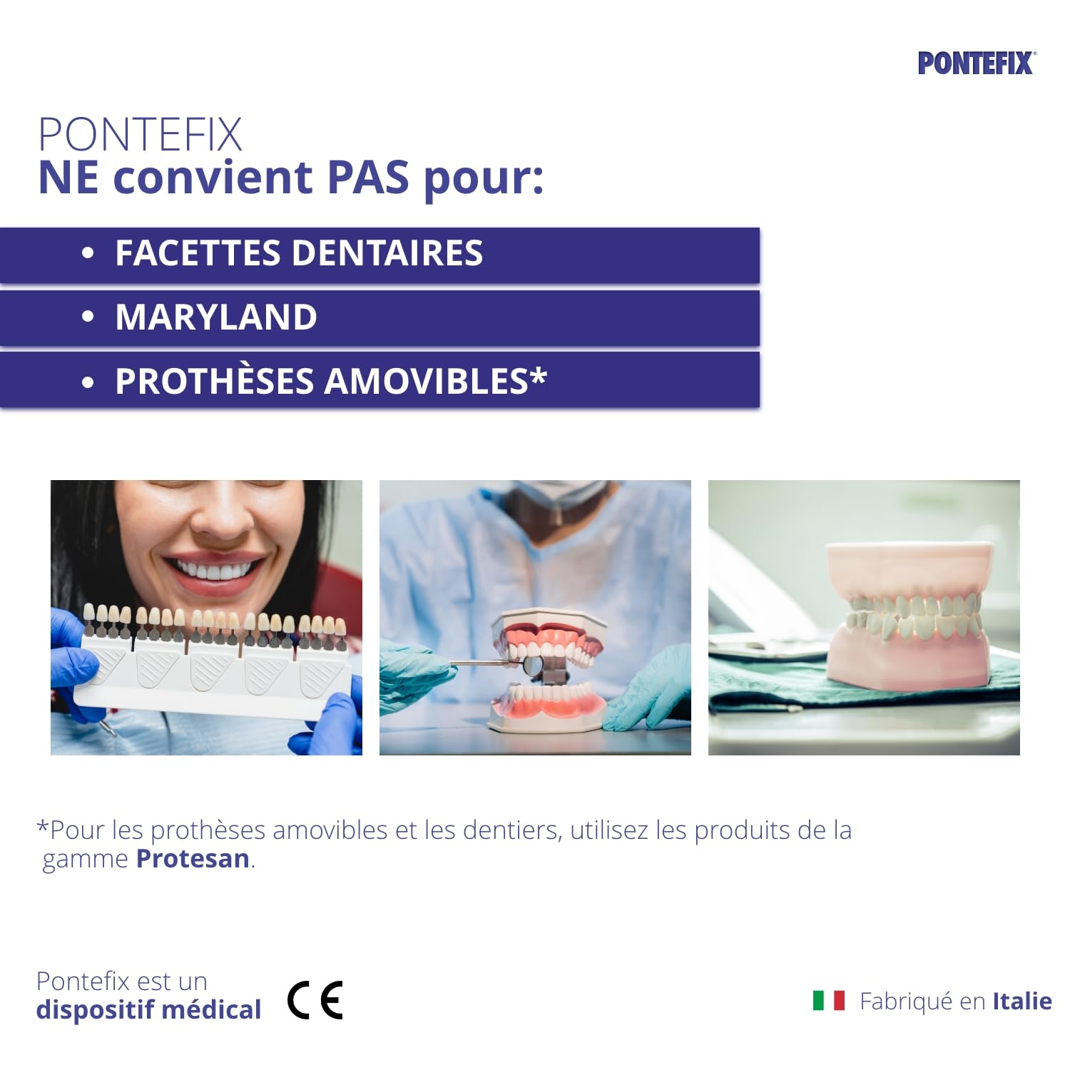 Ciment Dentaire, pour Resceller Couronnes ou Bridges- Fixe les Bridges, les Capsules Dentaires et les Dents Pivotantes