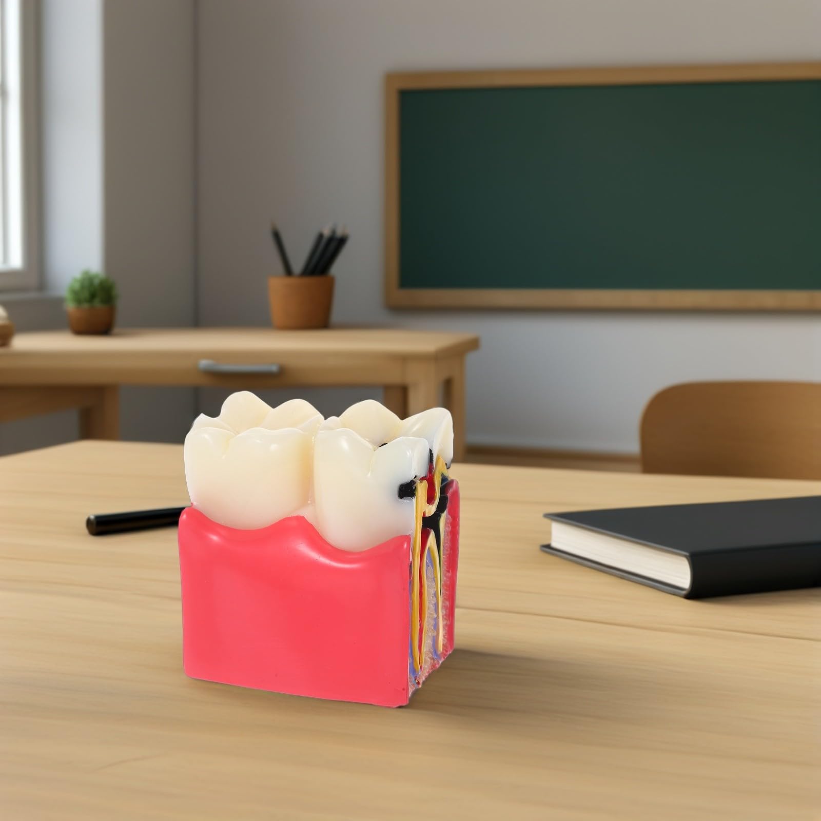 BESTYASH Modèle Pédagogique de Caries Dentaires à 6x Grossissement en Résine, Outil Typodont D'anatomie Comparée Dents Saines Vs Cariées, pour Enseignement en École et Cabinet