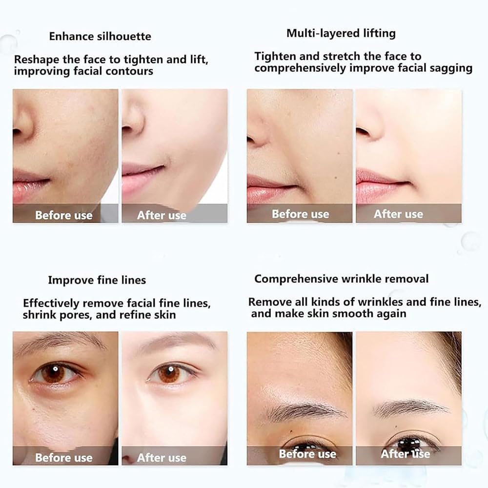 Máquina Hifu Reafirmante Profesional,Máquina de Belleza Facial para Lifting,Tonificar,Reafirmar y Eliminar Arrugas,con 2 Cabezales,Pantalla táctil y Ajuste multinivel