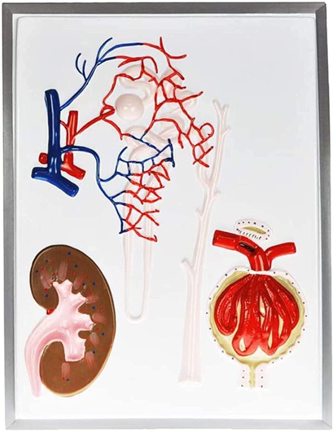 GTHTUHFD Anatomy Model, Human Model, Science Education Model Unit And Renal Corpuscle Model Renal Unit And Renal Corpuscle Model Human Organ Model Skeleton Model