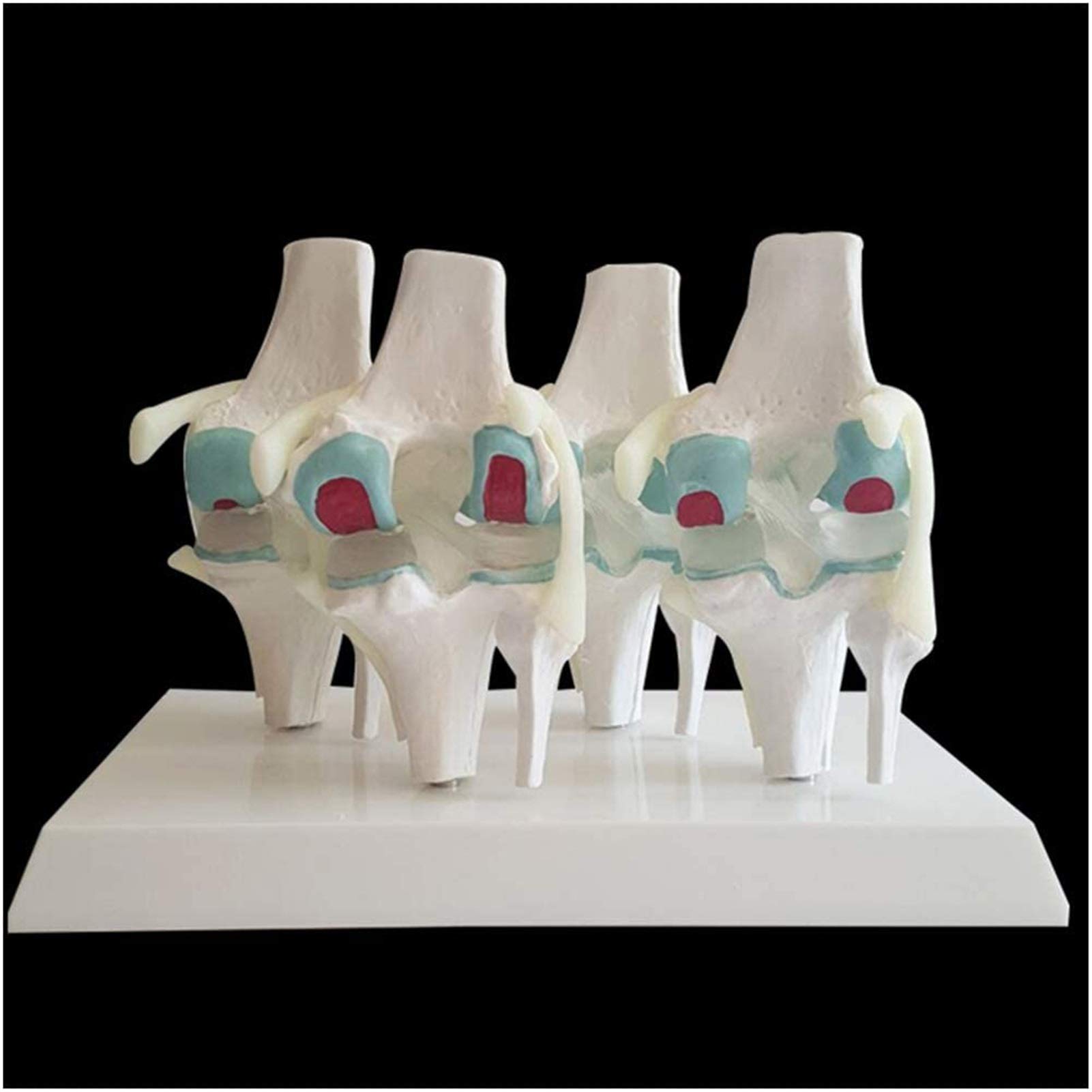 Modular Knee Model Knee Joint Model Human Lesion Knee Anatomy Model 4 Stage | Desertcart ...